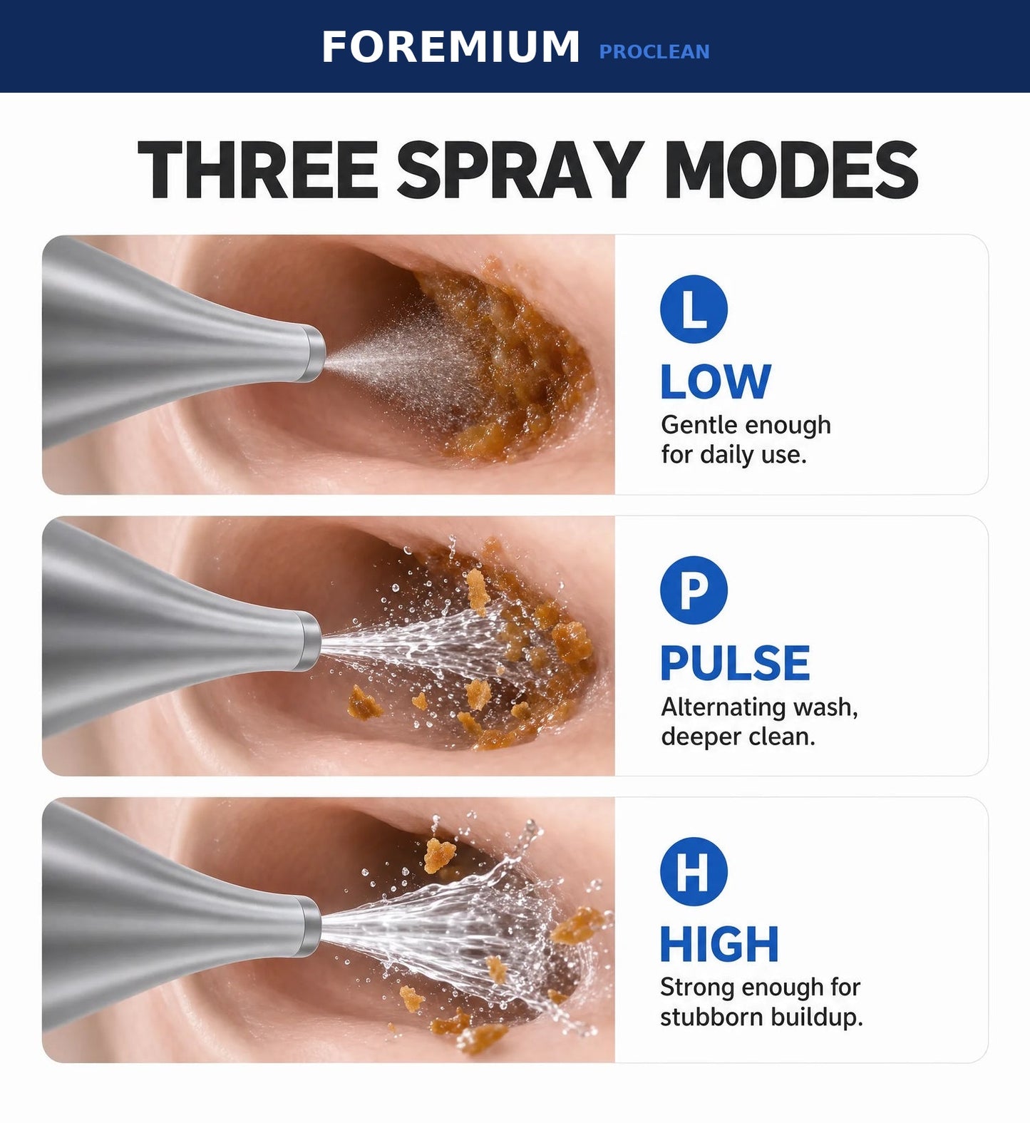 Foremium ProClean Ear Wax Removal Kit
